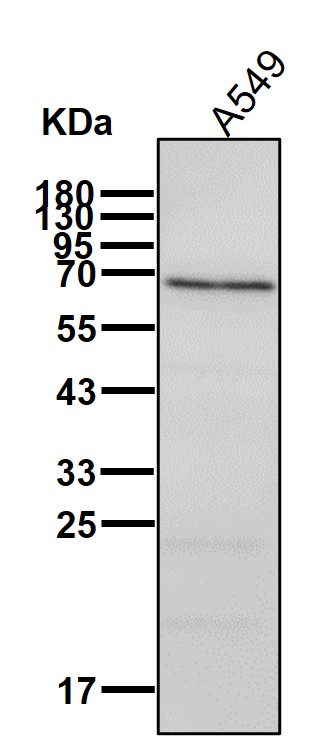 Rabbit Monoclonal to TGFBI