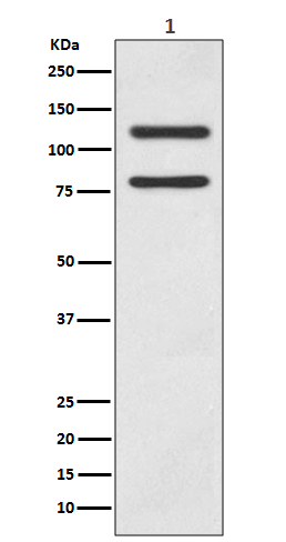 Rabbit Monoclonal to ECadherin
