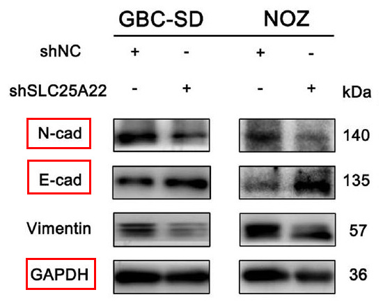 Rabbit Monoclonal to ECadherin