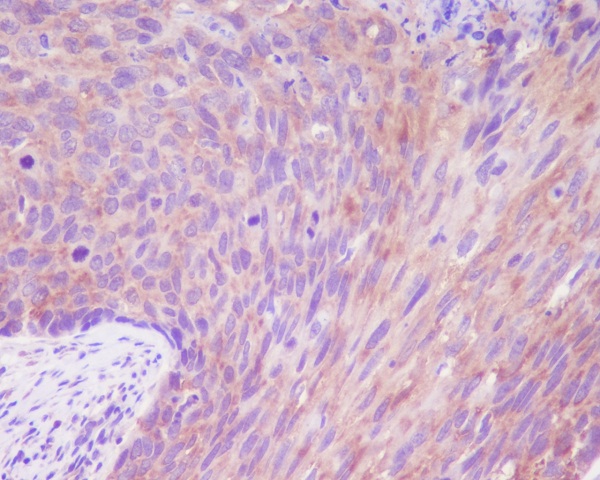 Rabbit Monoclonal to DSG1