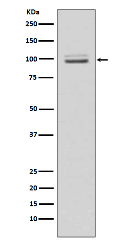 Rabbit Monoclonal to MKLP1
