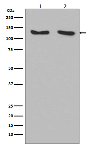 Rabbit Monoclonal to RNF20
