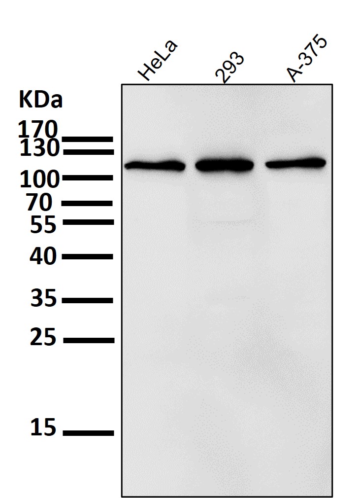 RNF20