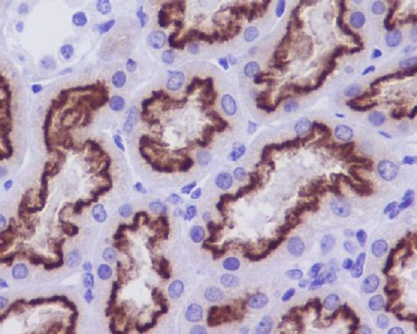 Rabbit Monoclonal to Cubilin