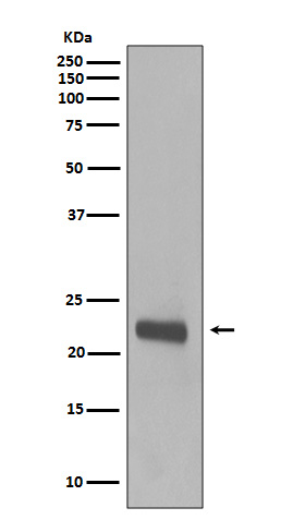Rabbit Monoclonal to Caveolin-1