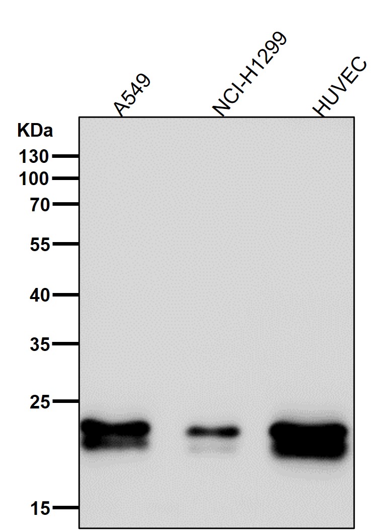 Rabbit Monoclonal to Caveolin-1