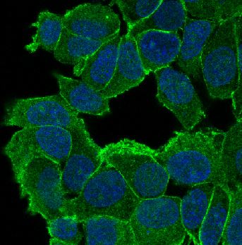 Rabbit Monoclonal to Catenin delta 1/CTNND1