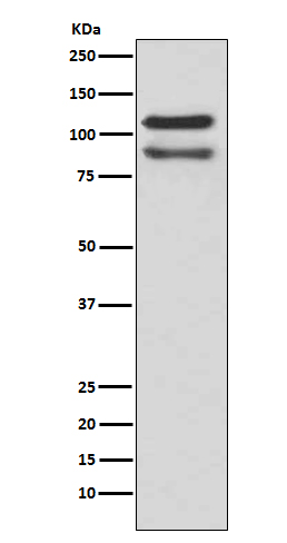 Rabbit Monoclonal to Catenin delta 1/CTNND1