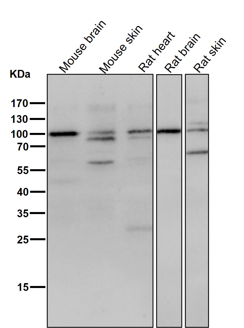 Catenin delta 1/CTNND1