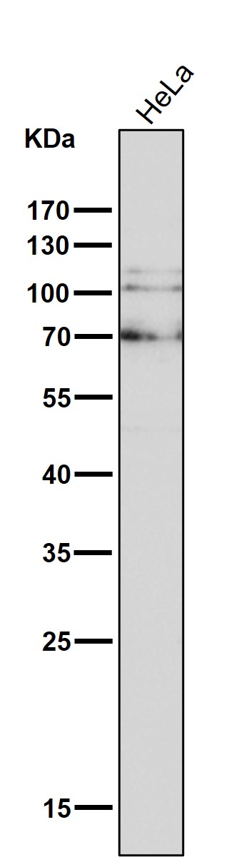 Rabbit Monoclonal to Catenin delta 1/CTNND1