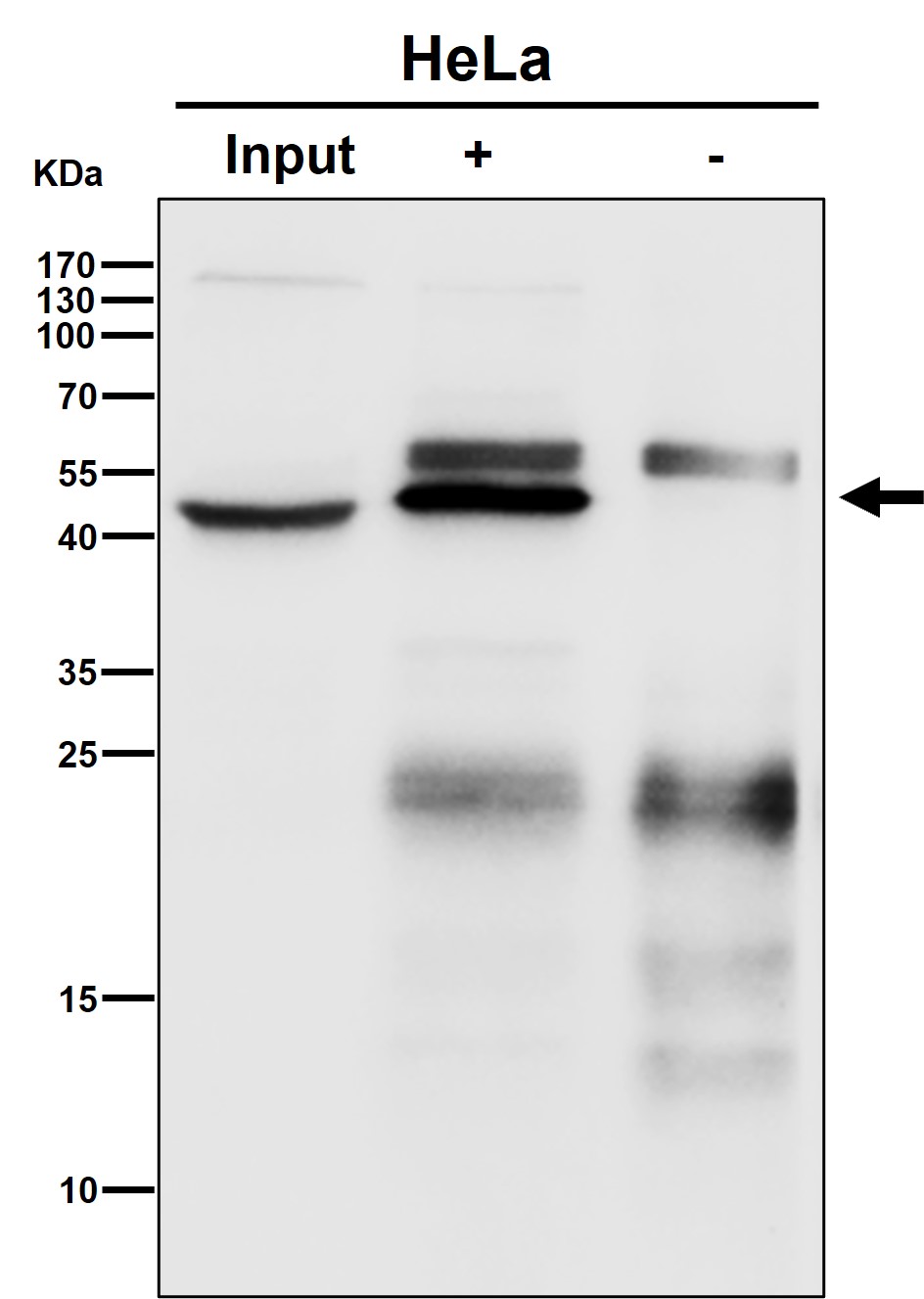Rabbit Monoclonal to MEK1
