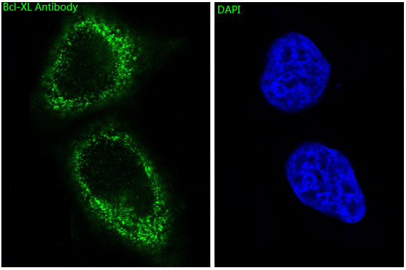 Rabbit Monoclonal to Bcl-XL