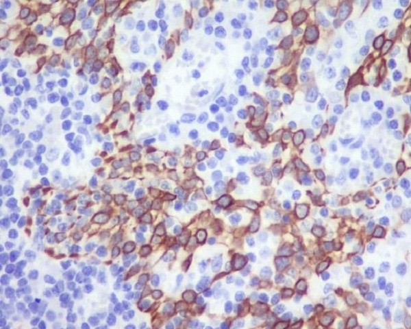 Rabbit Monoclonal to CCR2/CKR2