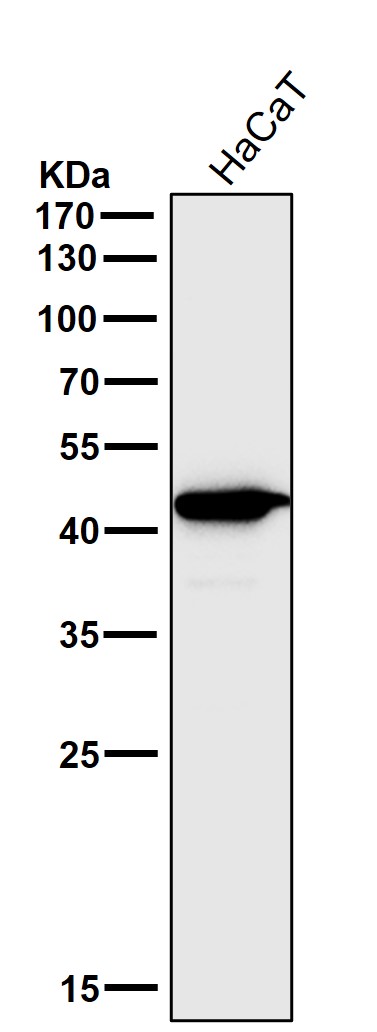 CCR2/CKR2