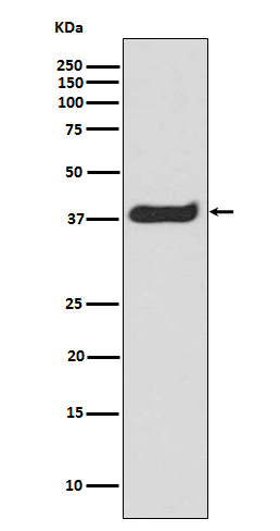 Phospho-LAT(Y191)