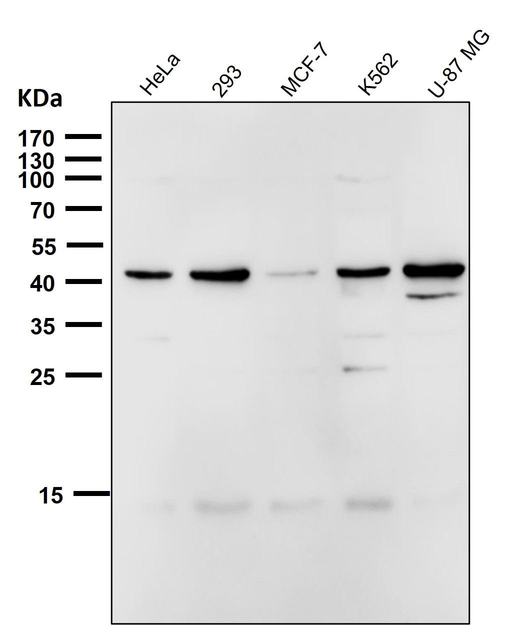CCR9