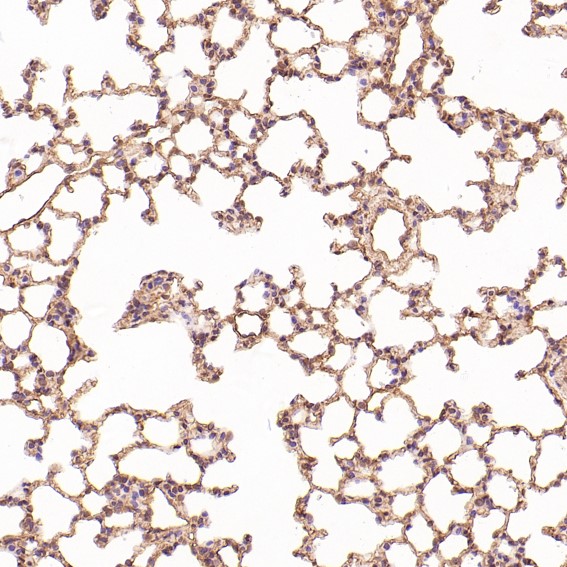 Rabbit Monoclonal to HMGB1