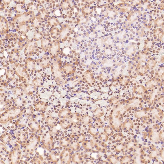 Rabbit Monoclonal to HMGB1