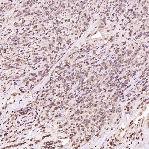 Rabbit Monoclonal to HMGB1