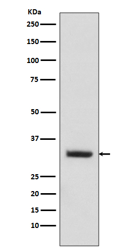C10orf63
