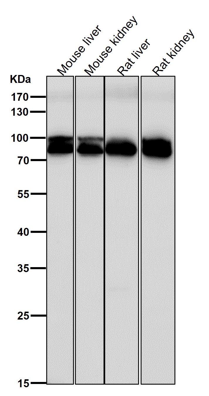Aconitase 1
