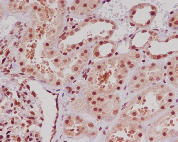 Rabbit Monoclonal to ERG