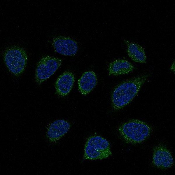 Rabbit Monoclonal to Smad2