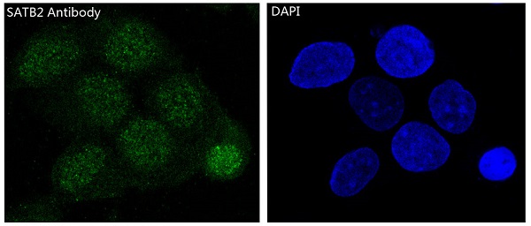 Rabbit Monoclonal to SATB2