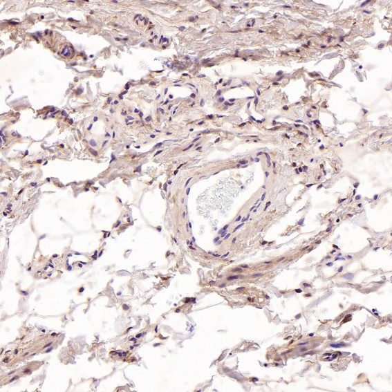 Rabbit Monoclonal to SATB2