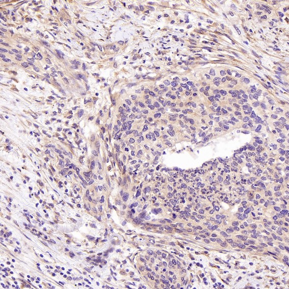 Rabbit Monoclonal to SATB2