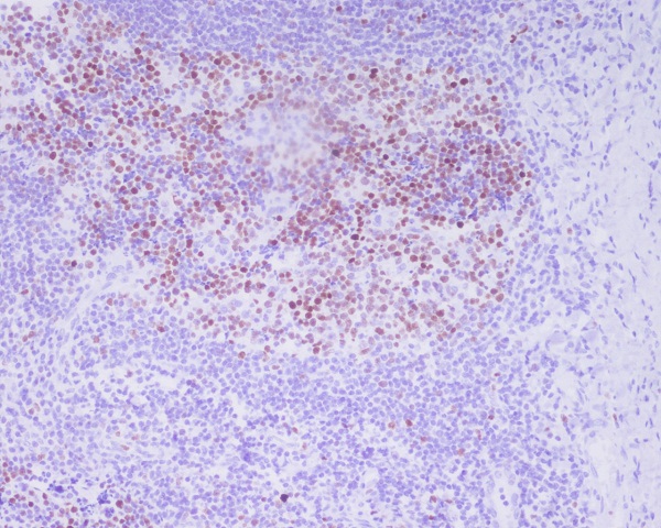Rabbit Monoclonal to Phospho-HistoneH3(T3)