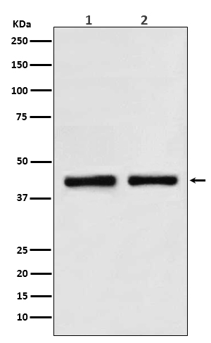 Rabbit Monoclonal to SNF5