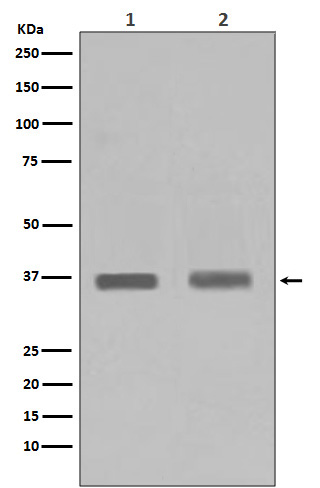 PPP1CA+1CB