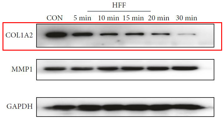 Rabbit Monoclonal to Collagen I