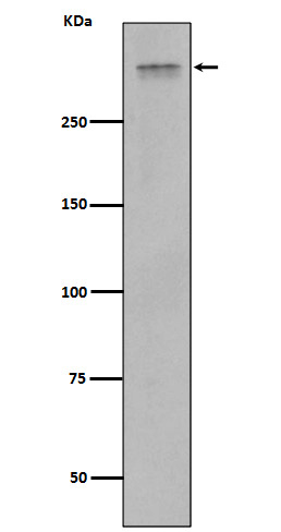 Rabbit Monoclonal to Plectin