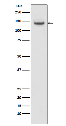 TACC3