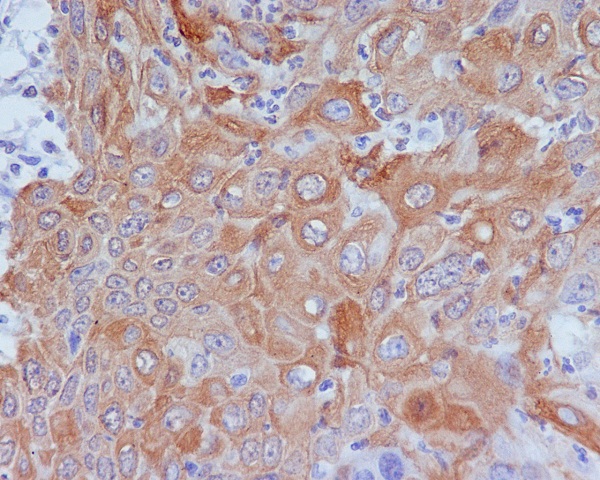 Rabbit Monoclonal to GM130