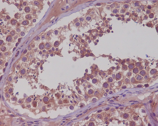 Rabbit Monoclonal to NAK/TBK1(N-term)