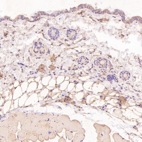 Rabbit Monoclonal to NAK/TBK1(N-term)