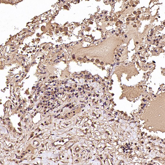 Rabbit Monoclonal to NAK/TBK1(N-term)