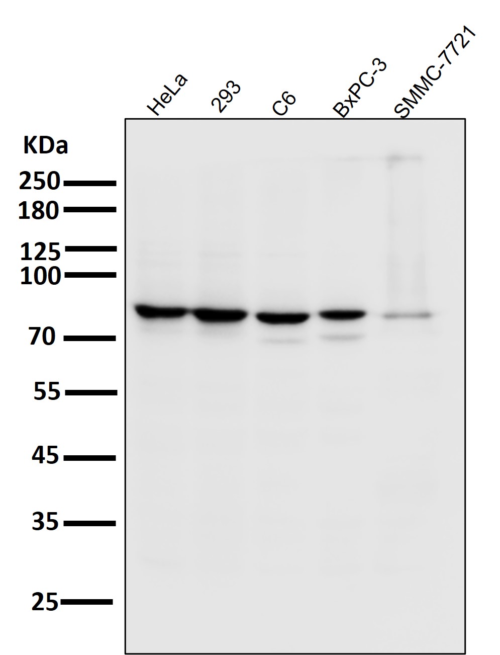 NAK/TBK1(N-term)