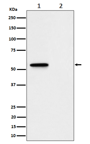 Rabbit Monoclonal to Phospho-MLKL(S345)