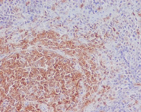 Rabbit Monoclonal to SHIP