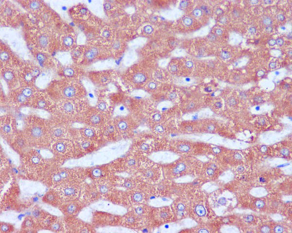 Rabbit Monoclonal to KDEL