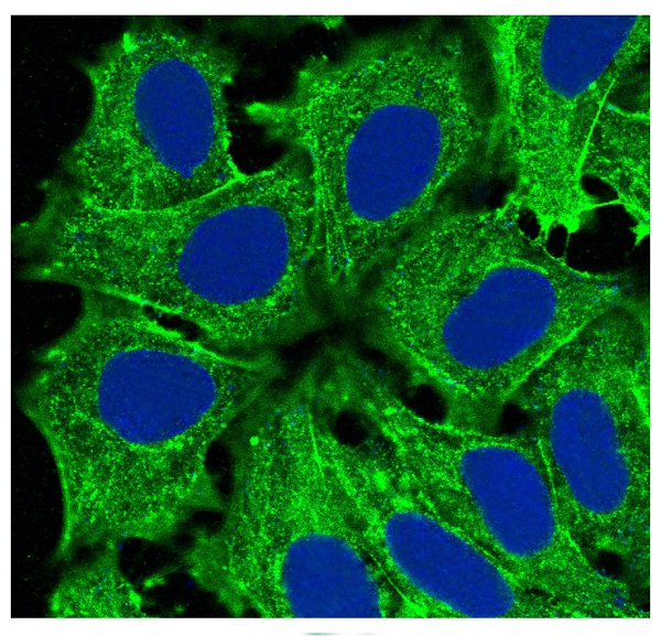 Rabbit Monoclonal to Actin(Alpha-Actin)