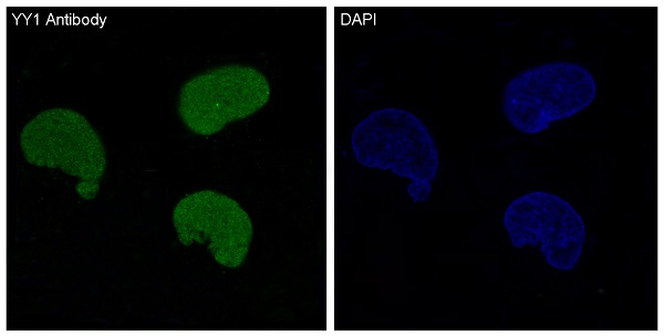 Rabbit Monoclonal to YY1