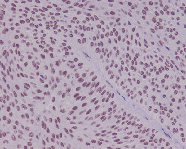 Rabbit Monoclonal to YY1