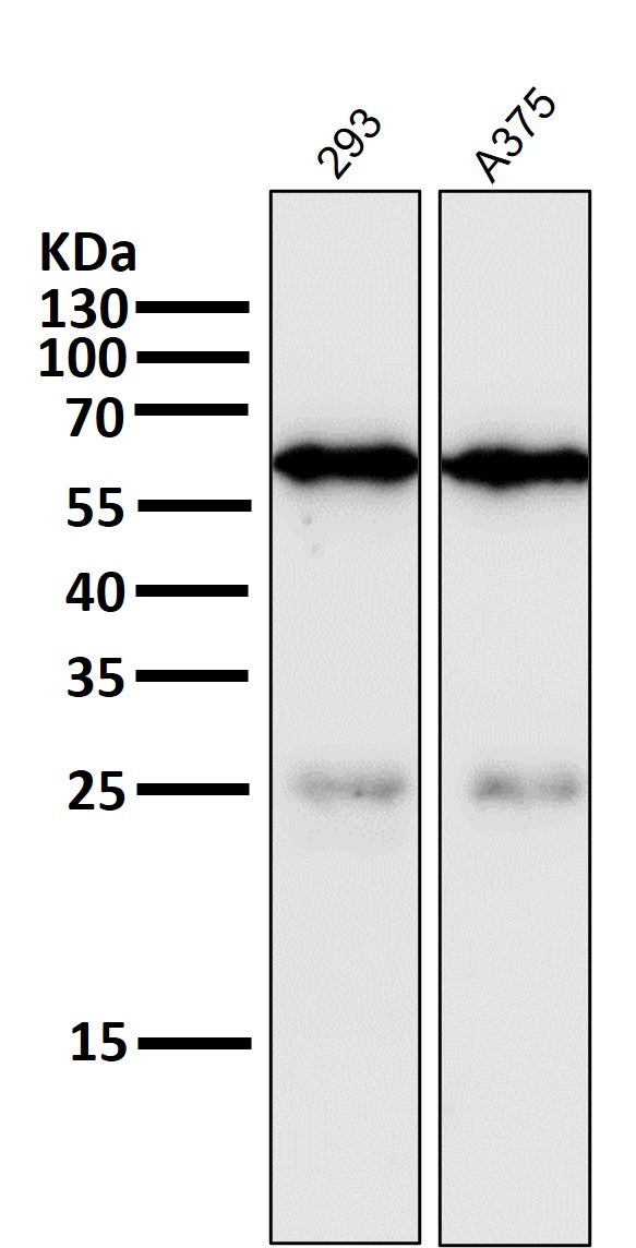 Rabbit Monoclonal to YY1