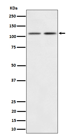 Rabbit Monoclonal to PI3 Kinase p110 beta