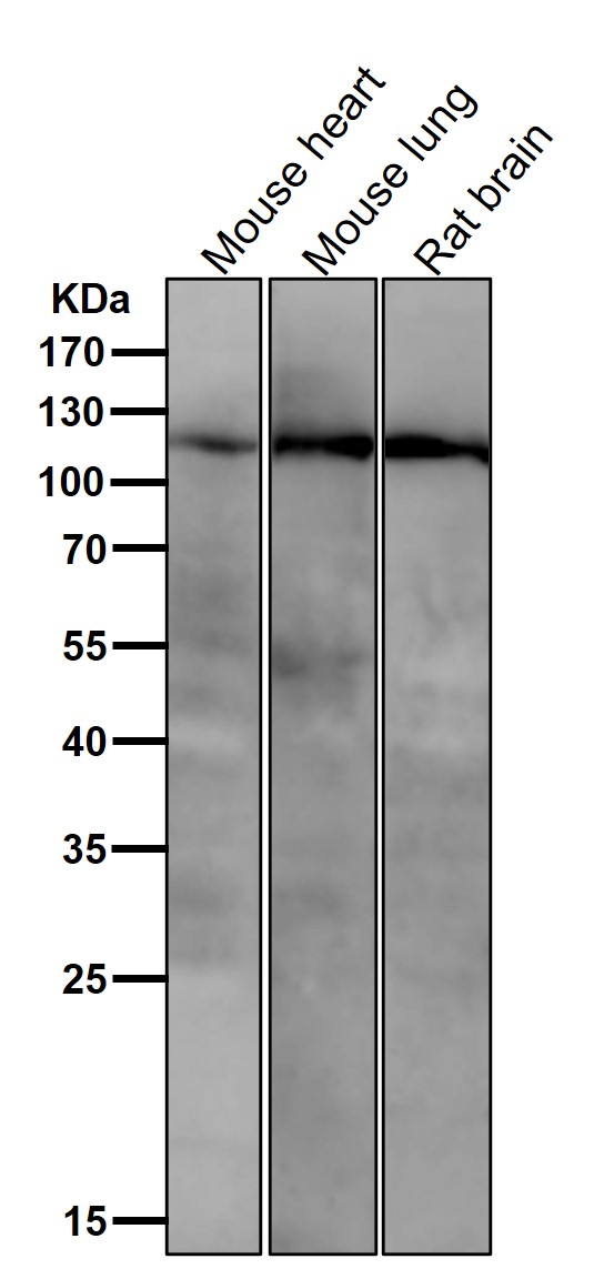 PI3 Kinase p110 beta